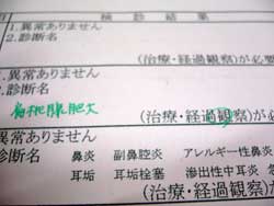 扁桃腺肥大