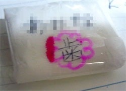 娘の乳歯5本目