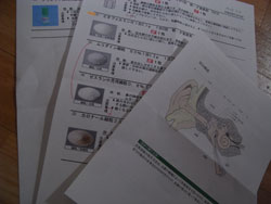 中耳炎切開